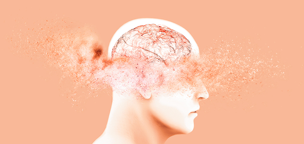 Memory,Lapses,,Forgetting,Things,,Degenerative,Disease.,Brain,Problems.,Parkinson,And