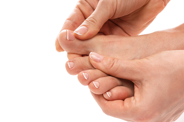 Female feet with itchy skin affected by fungal infection