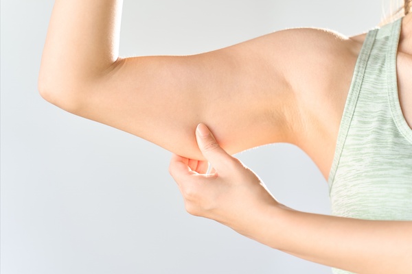 A woman stretching her upper arms