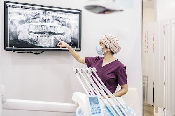 Dental Clinic Worker Showing X-ray